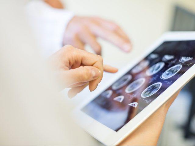 medical team analyzing brain scans on a digital tablet