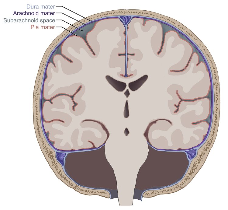 A coronal view of the meningeal layers of the brain showing the dura mater, arachnoid mater, subarachnoid space, and pia mater as they surround the brain.