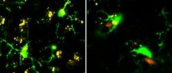 The confocal image in the left panel above shows activated microglia (denoted by the increased size of the cell body and the thickening of proximal processes) with the suppressive effect of NK cells absent in situ. Compared to mice with intact NK cells, the level of reactive oxygen species (a key indicator of inflammation) is significantly higher in mice lacking NK cells (left panel). The right panel shows PE-positive natural killer cells and green fluoresence-positive microglia in brain sections from an EAE model.
