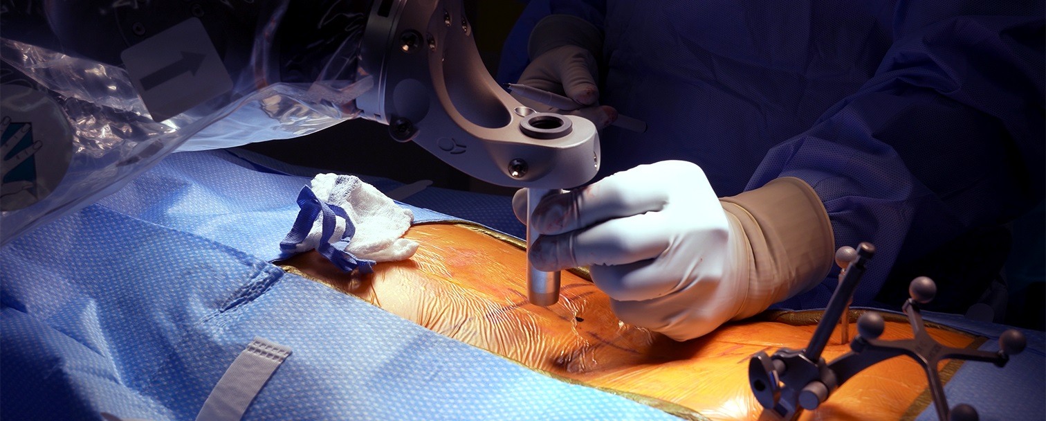 globus excelsius robot performing robotic spine surgery
