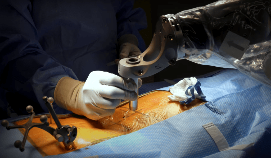 Neurosurgeon using spinal robot during surgery