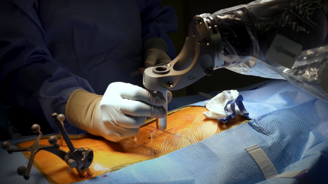 Neurosurgeon using spinal robot during surgery