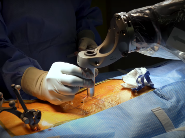 Neurosurgeon using spinal robot during surgery