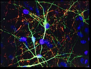 sattler-lab-neurons