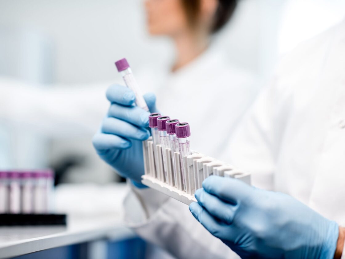 stock image of a laboratory worker holding test tubes