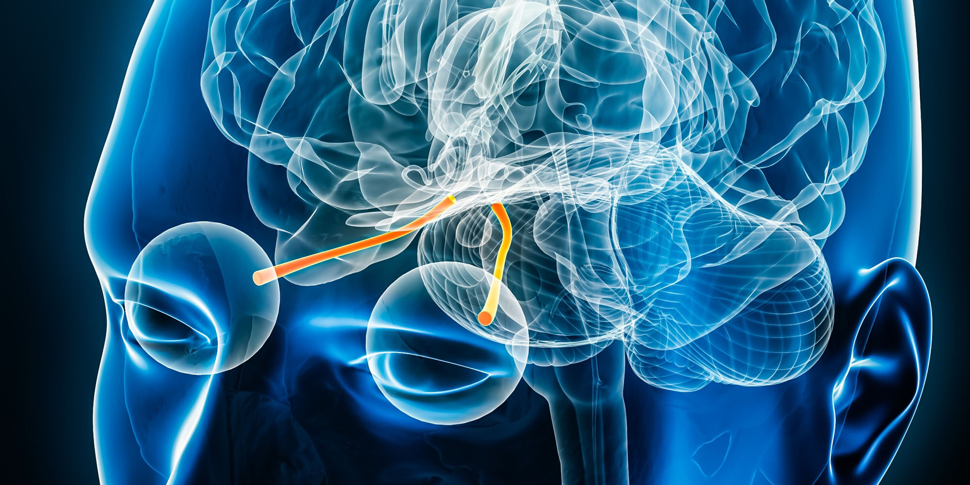 Stylized illustration of the optic nerves connecting to the brain.