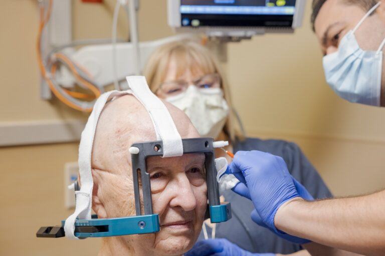 Focused Ultrasound for Parkinson's and Essential Tremor Barrow